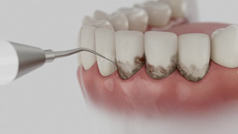 Reliable Teeth Cleaning And Checkup contractor in Jackson County County, KS by Dentist Open Now